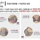 아이디얼라인 이미지