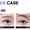 팝성형외과의원 이미지