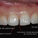 스타일치과기공 네이버블로그