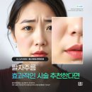 팔자주름 시술 추천 l 유형별 맞춤 시술 선택 가이드 #울산비비성형외과