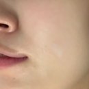 오투 | 압구정로데오 피부과 임산부 수분 폭탄 오투덤 산소테라피 후기