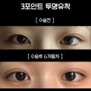 아이그램성형외과 이미지