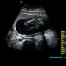 순산부인과의원 이미지