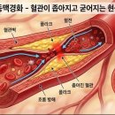 혈관 이미지