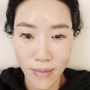 P-6920 | 대전둔산동피부관리 모노뷰티에서 피부변신중