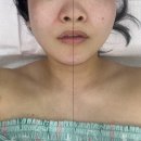전신 조각 몸매만들기 후기 소희에스테틱