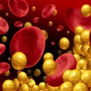 고지혈증의 이해와 관리 이미지