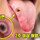 𐩕 돌연사 직전에 나타나는 증세 5 이미지