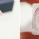 트레졸리 네이버블로그