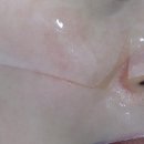 코마시스 이미지