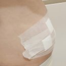 수원전담 | 수원광교 1:1 서울대전담의 다이어트병원 지방분해주사 후기