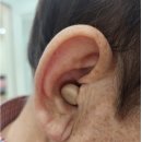 시그니아독일보청기일산서구센터