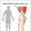 내측, 외측 측부인대는 무엇인가요? 이미지
