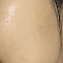 티엔메디 | 약산성폼클렌징 메디티엔 여드름 폼클렌징 좁쌀여드름 사용후기