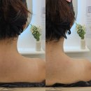 예뻐졌다 | 부천두피관리 예뻐졌다 승모근 관리 후기