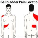 청계의원 | 5년을 아플 일인가? 대학/종합병원 응급실을 방문해도... ; 담낭기원 증상의 의심, 담낭 오니 혹은 모래...