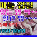 마늘껍질 효능 9가지 + = 항암작용 | 동맥경화 | 남성건강 | 당뇨 | 지방게거, 다이어트 | 뇌건강 | 노화방지, 피로회복 | 고 이미지