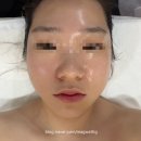 부천 피부관리 벨르바디 2회차 추천
