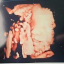 탄방우리약국 | [미즈맘케어 산전마사지 후기] 탄방미즈산후조리원 산전마사지, 7층 조리원 부설 미즈맘 케어 산전...