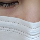 아그네스 | 반포피부과 아그네스 눈밑 한관종 제거 후기 (+나비존 어븀 레이저, 애교 필러 녹이기)