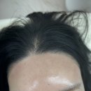 하진헤어아트 | 진해 용원 &#34;뷰티오늘&#34; 헤어라인 후기(저통증, 저자극) 자연스럽고 깔끔한 라인 완성!