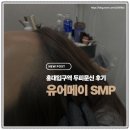 홍대입구SMP 홍대SMP 두피문신 유어메이 SMP 시술 후기