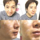 나르샤코스메틱 | [5차 공구]산수시데포세럼+아쿠아클리어스틱 착한가격 받아가용♡