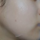 (주)닥터글로덤 | 닥터글로덤 알약크림&알약마스크 사용후기