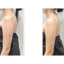 대전 체형관리샵, 레몬슈가링왁싱 대전 둔산점에서 더조각테라피 후기