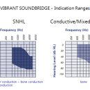 보청기클리닉 이미지