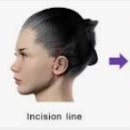 위드윈피부과의원 이미지