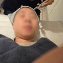 [압구정 반딧불의원] 기미 흑자 레이저+얼굴제모 내돈내산 솔직후기 2탄