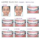 미소라인 이미지