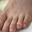 레푸스인하대역점 내성발톱 무좀발톱 발각질 문제성발 | 인천발톱관리 레푸스 인하대역점내성발톱 무좀발톱 발각질 문제성발 속 시원하네요