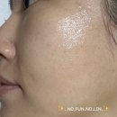 셀키 | [협찬] 피부과화장품 스킨부스터 셀키샷