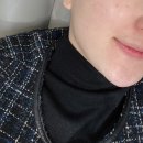 당신만의가치벨유의원 | 명동피부과 내돈내산 기미잡티관리 피코슈어토닝 후기!