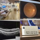 글로벌안과의원 | 강남 스마일라식 어디서 받을까? 밝은눈안과 규모·시스템 정리