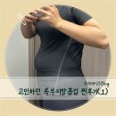 아이러브 대리운전 | 복부지방흡입 재수술 찐 후기 손품발품 다 팔아 질러버린 N차 지방흡입