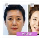 미성형피부과 Daum카페