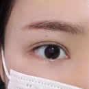 서면 애교살은 브로우돌 탈각 후기