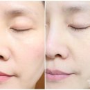제이제이약국 | 잡티 좁쌀여드름 모공 케어해줄 허브마사지바 클렌징 비누 사용 후기