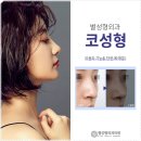 별성형외과 네이버블로그