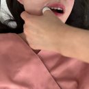 효병원1(도리티고개) | 수원 안면비대칭 교정 후기, 사진 찍을 때 달라진 내 얼굴, 1회 시술만으로 달라지기!