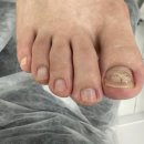 레푸스인하대역점 내성발톱 무좀발톱 발각질 문제성발 | 인천내성발톱 관리 편하게 받았던 레푸스 인하대역점