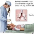 기관지 내시경 검사[bronchoscopy] 이미지