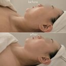 김정문알로에 분당지점 | 여심저격 피부샵 만족스런 후기