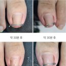 페디베네 이미지