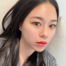 홍대피부과 필러카세 이마필러 한달차 후기 통증 부작용