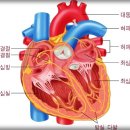 급성심근경색(홍보) 이미지