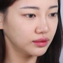 까만코 | 코 피지 제거 까만 점 고민이라면 방법을 바꿔보세요